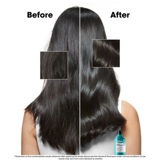 Scalp Advanced Anti-Dandruff