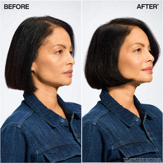 Acidic Grow Full System Scalp & Hair Serum for Thin or Flat Hair