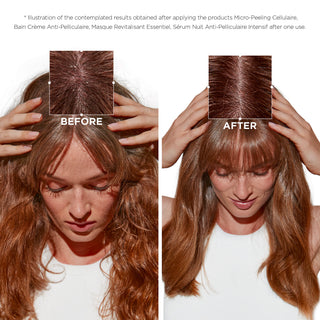 Symbiose Micro-Peeling Cellulaire