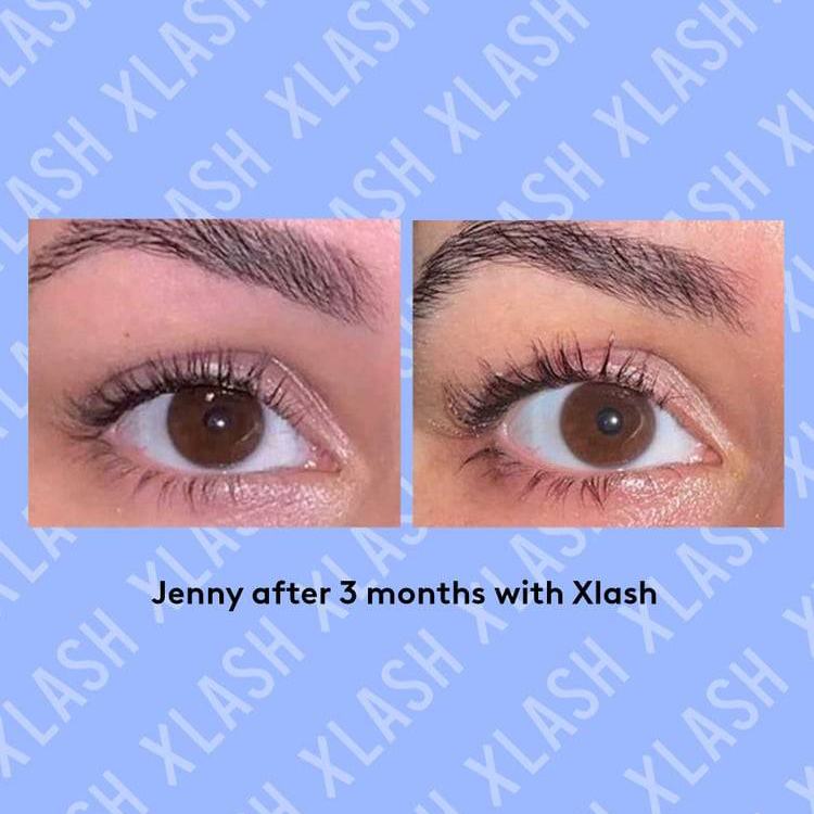 XLASH Eyelash Serum - Hairsale.se